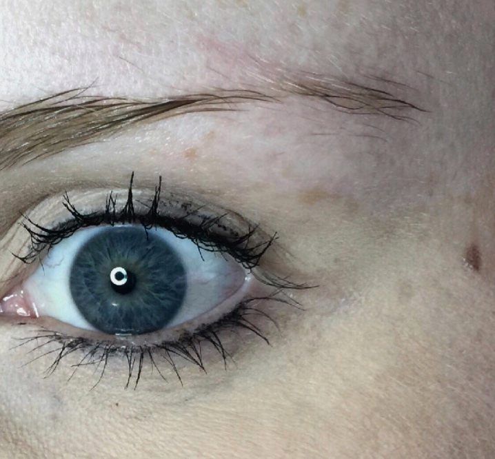 Sparse, light brows